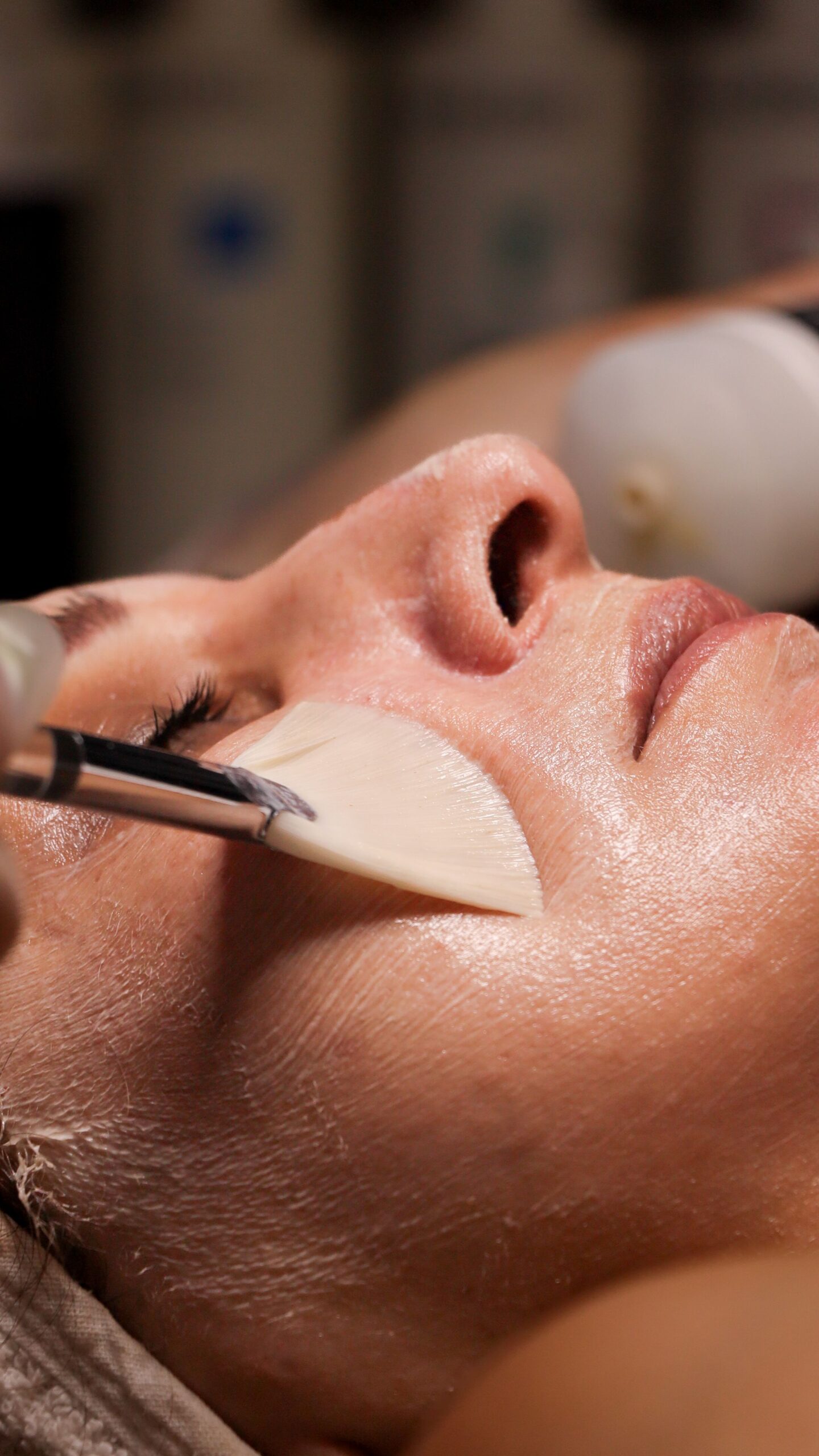 Close-up of professional peel application during a customized chemical peel facial